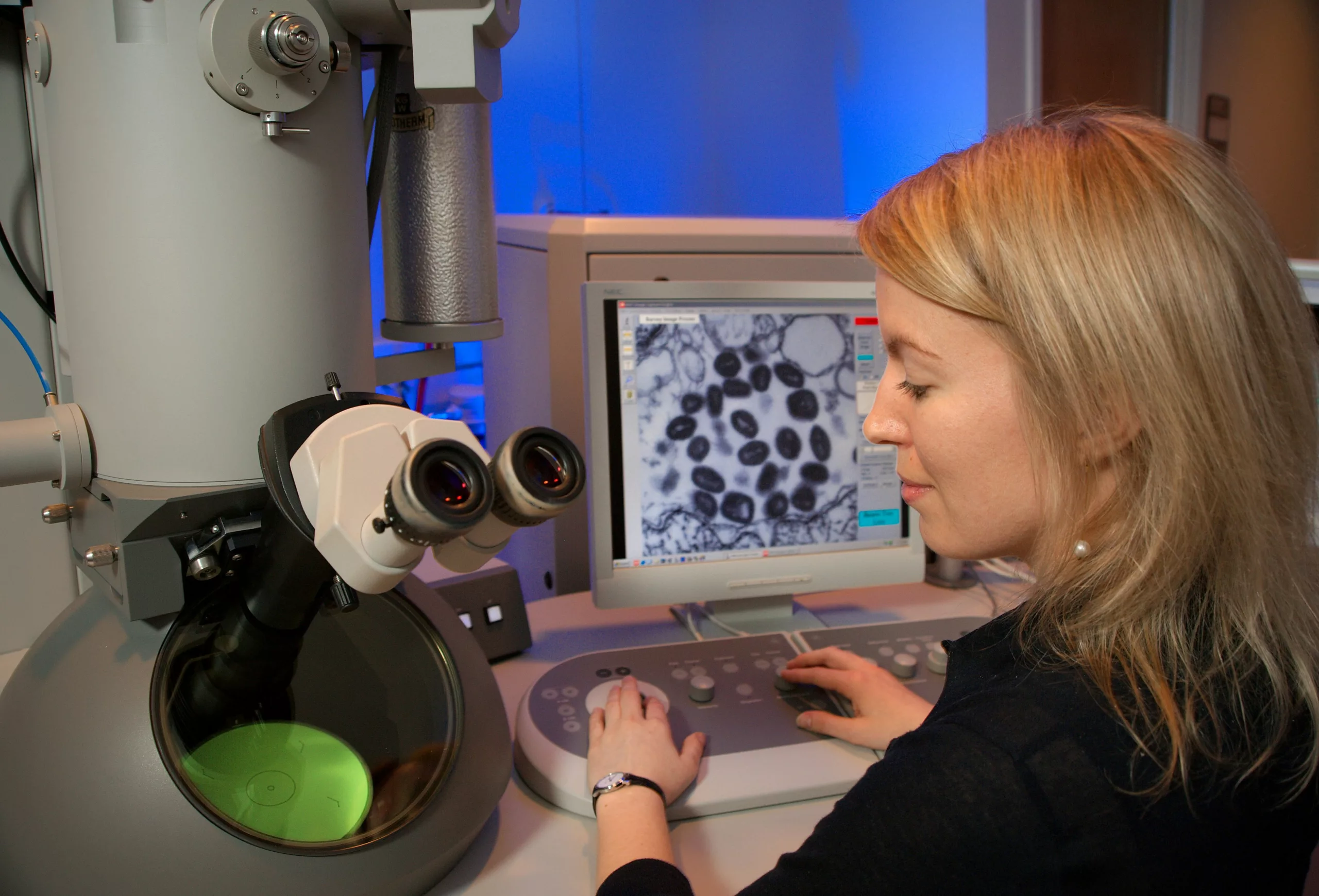 Autoimmune Diseases Why they occur and what the science says